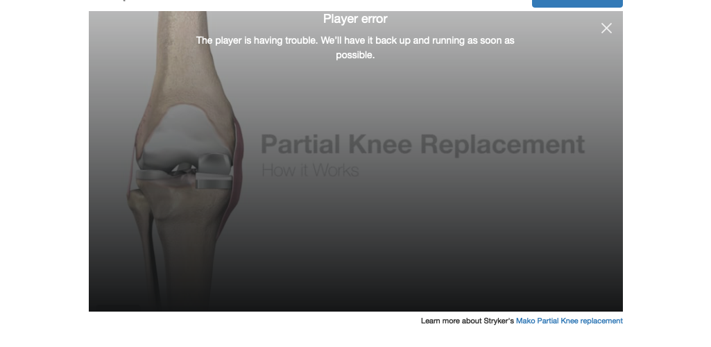 Mako partial knee replacement video