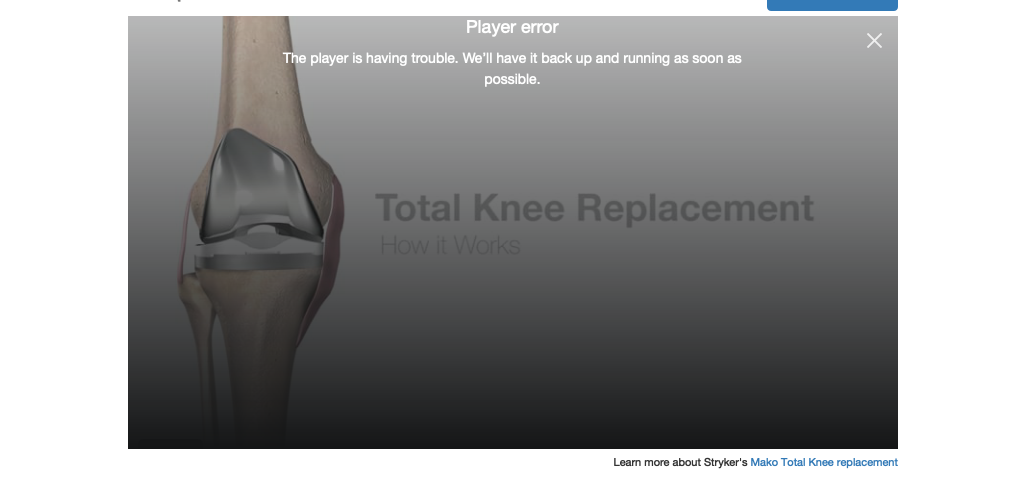 Mako total knee replacement video